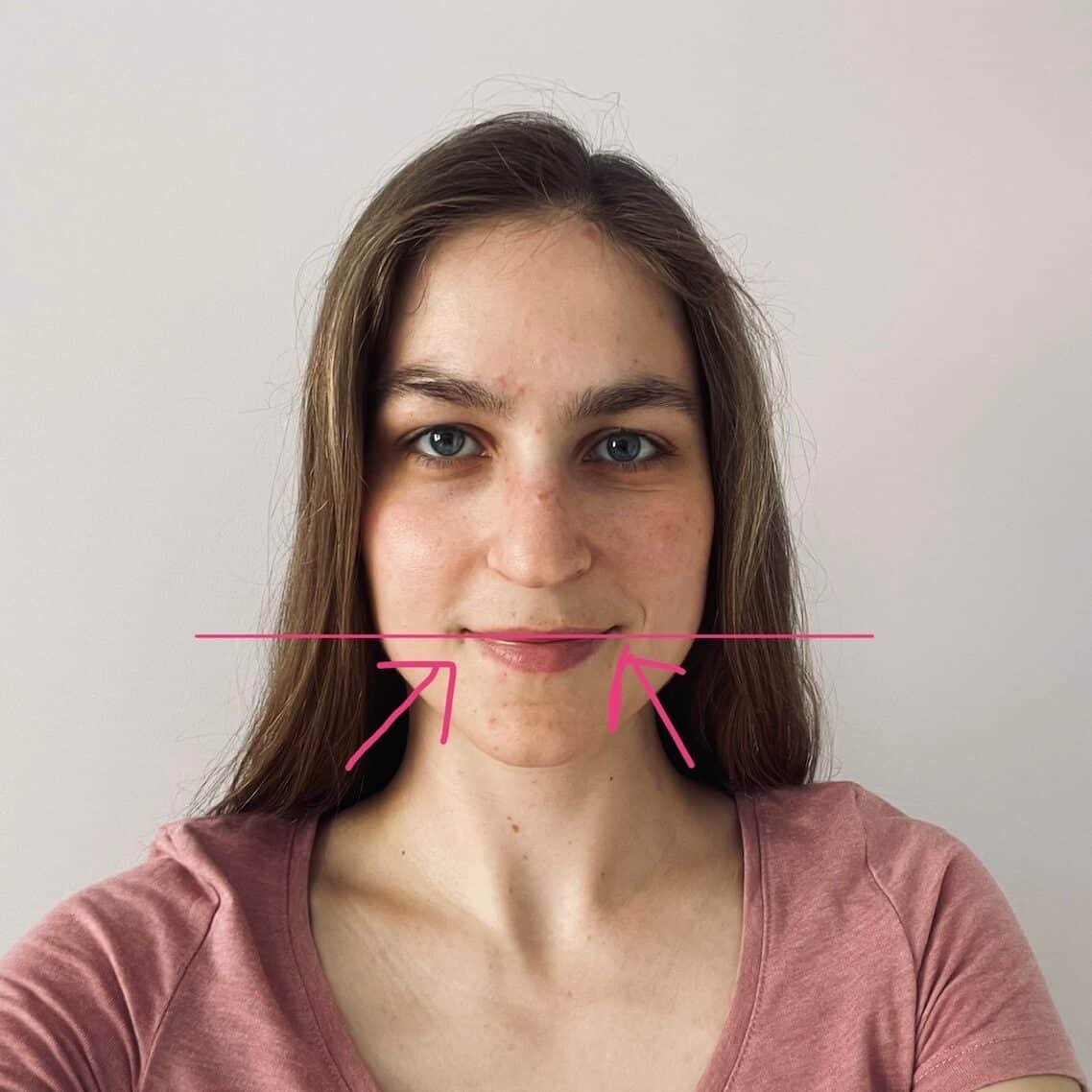 linia ust_analiza twarzy pod kątem dolegliwości ze stawu-skroniowo żuchwowego