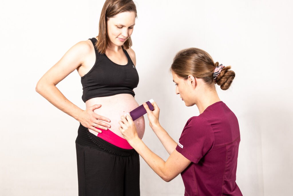 Kinesiotaping w ciąży na rozejście mięśnia prostego brzucha